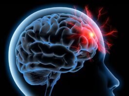 Lutte contre les AVC : le Maroc passe à l’action